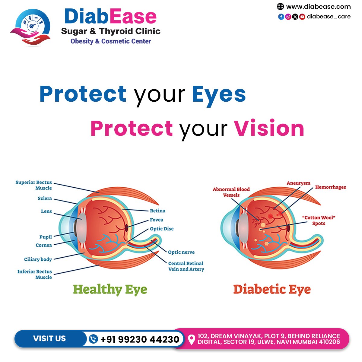 Diabetic Retinopathy Consultation